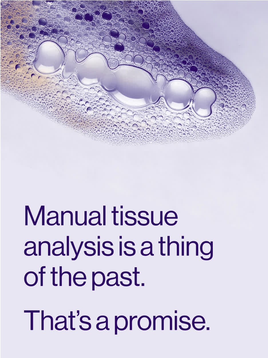 Violet foam: “Manual tissue analysis is a thing of the past. That’s a promise.”